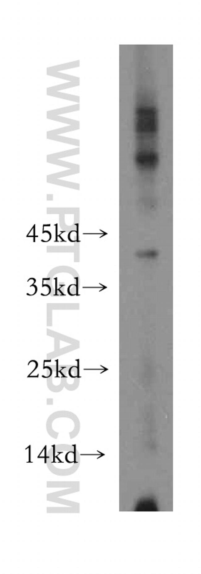 VASH2 Antibody in Western Blot (WB)