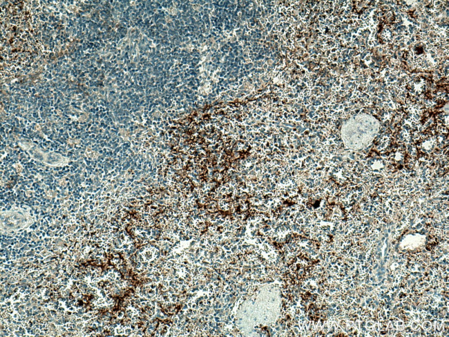 P-selectin Antibody in Immunohistochemistry (Paraffin) (IHC (P))