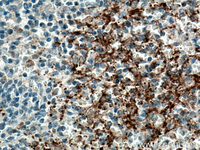 P-selectin Antibody in Immunohistochemistry (Paraffin) (IHC (P))