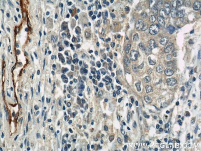 P-selectin Antibody in Immunohistochemistry (Paraffin) (IHC (P))