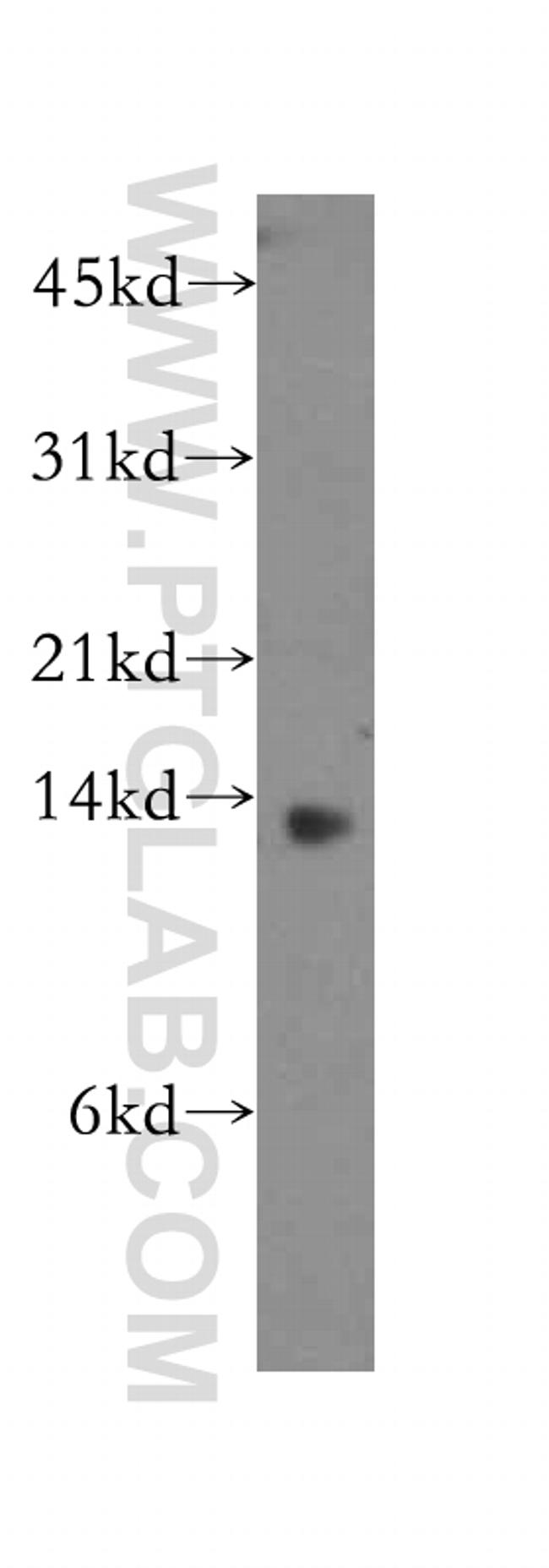 GHRL Antibody in Western Blot (WB)