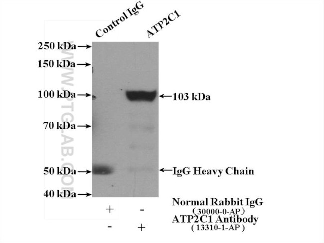ATP2C1 Antibody in Immunoprecipitation (IP)