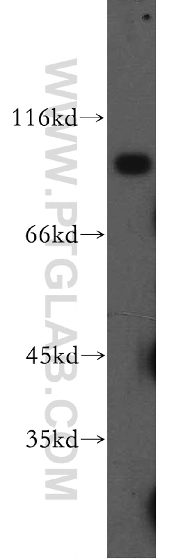 ATP2C1 Antibody in Western Blot (WB)