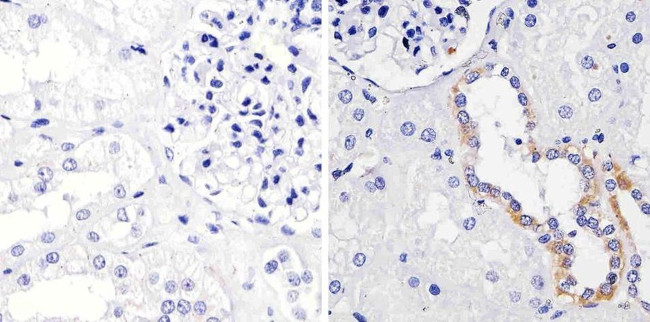 FGFR1 Antibody in Immunohistochemistry (Paraffin) (IHC (P))