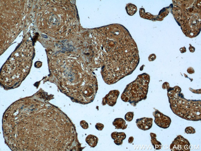 PPBP/NAP2 Antibody in Immunohistochemistry (Paraffin) (IHC (P))