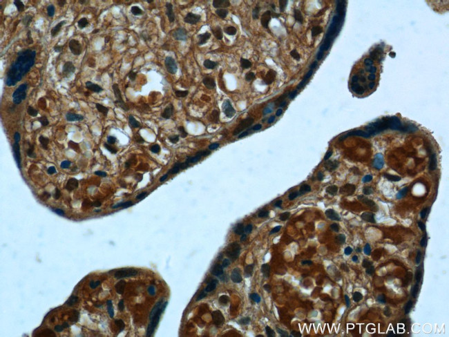 PPBP/NAP2 Antibody in Immunohistochemistry (Paraffin) (IHC (P))