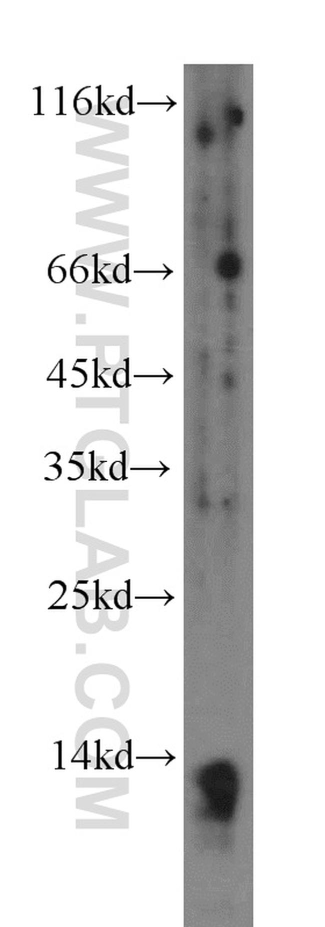 PPBP/NAP2 Antibody in Western Blot (WB)