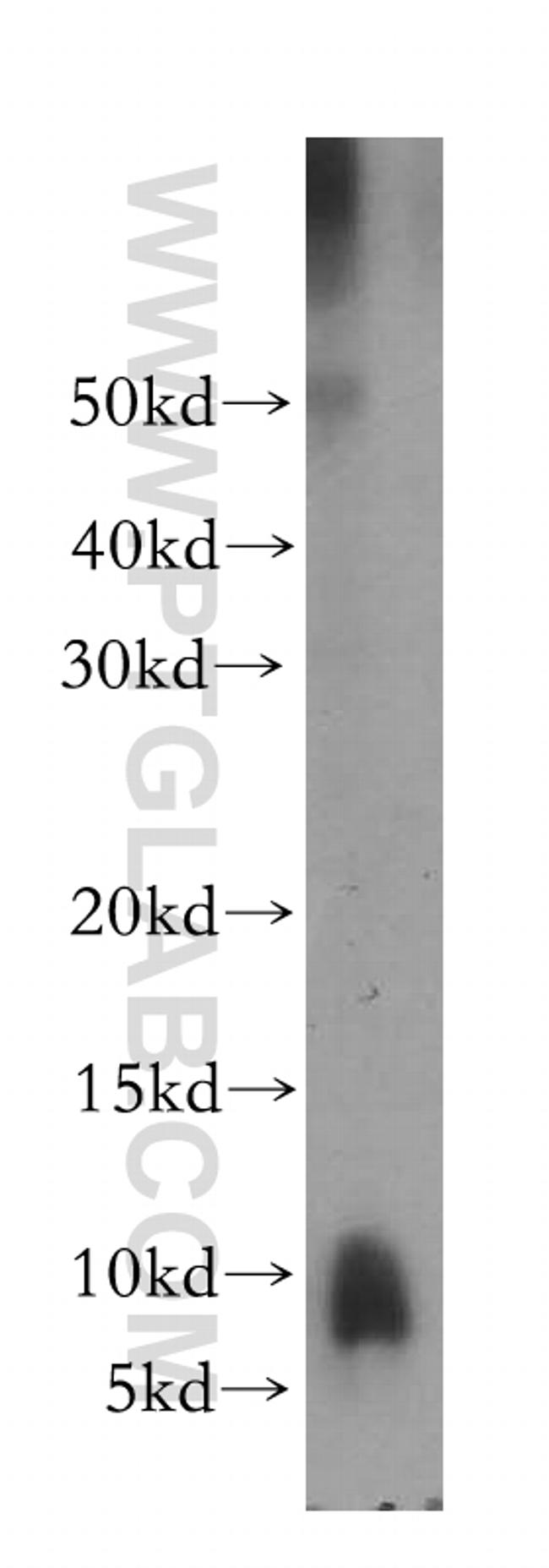 PPBP/NAP2 Antibody in Western Blot (WB)