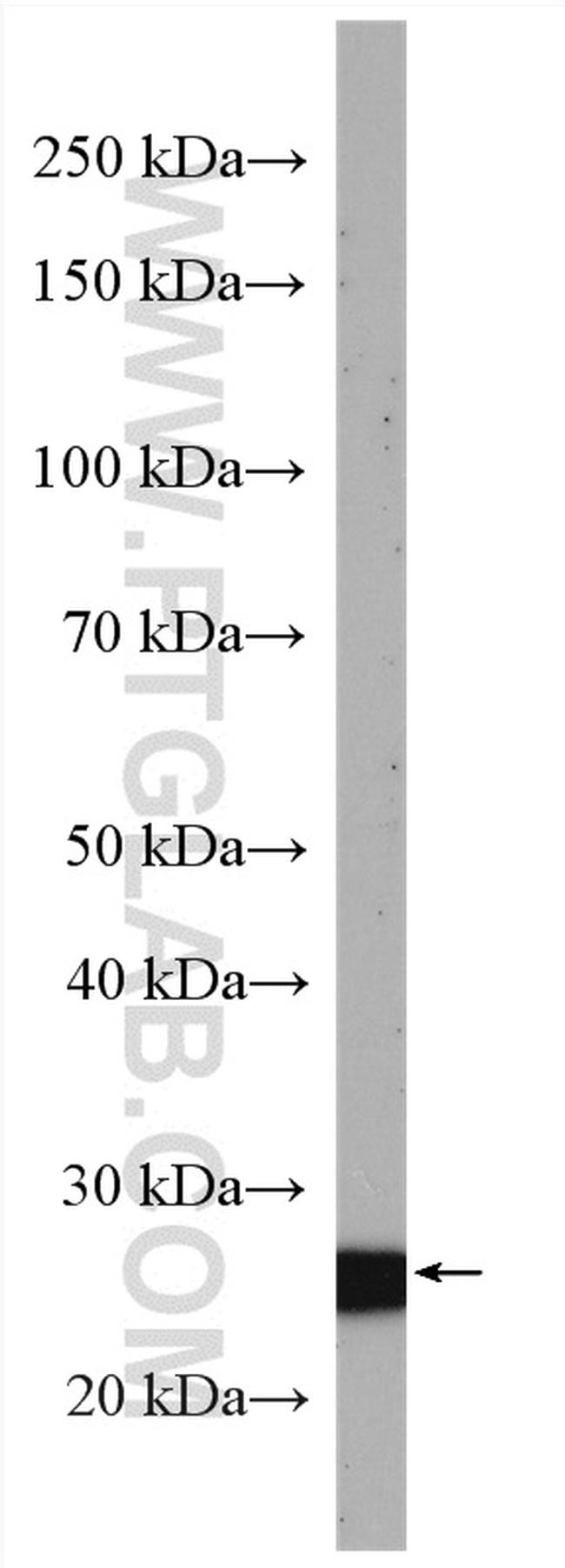 SLD5 Antibody in Western Blot (WB)