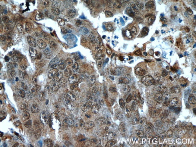 Cytoglobin Antibody in Immunohistochemistry (Paraffin) (IHC (P))