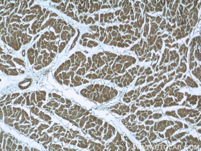 Cytoglobin Antibody in Immunohistochemistry (Paraffin) (IHC (P))