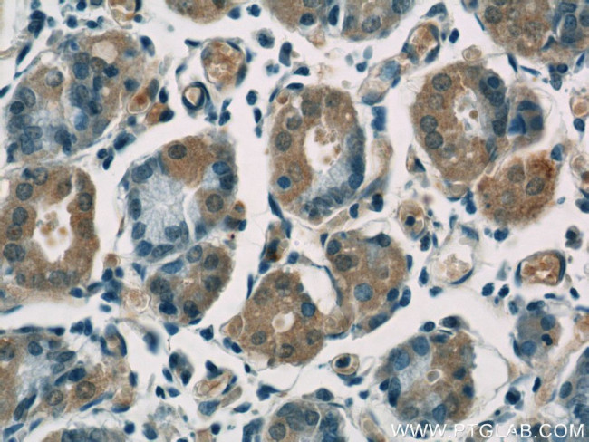 Cytoglobin Antibody in Immunohistochemistry (Paraffin) (IHC (P))