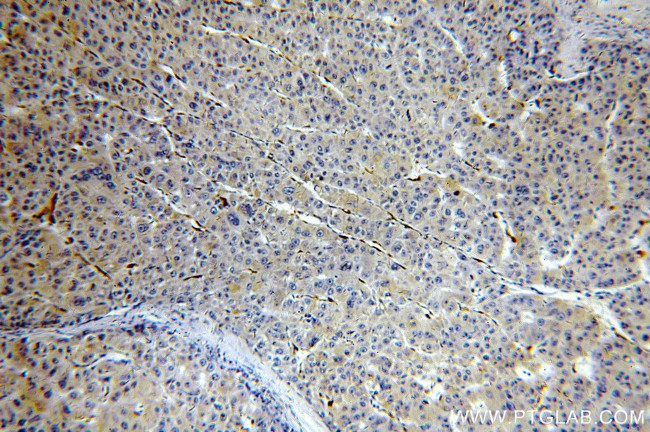 Cytoglobin Antibody in Immunohistochemistry (Paraffin) (IHC (P))