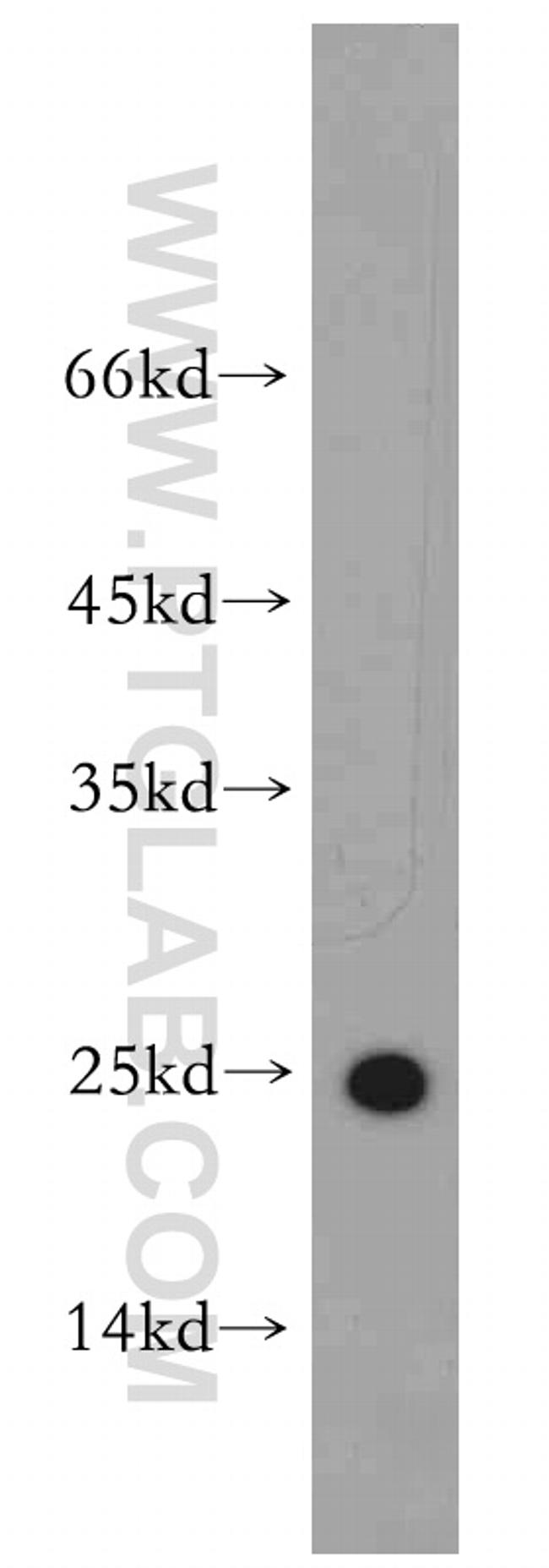 Cytoglobin Antibody in Western Blot (WB)