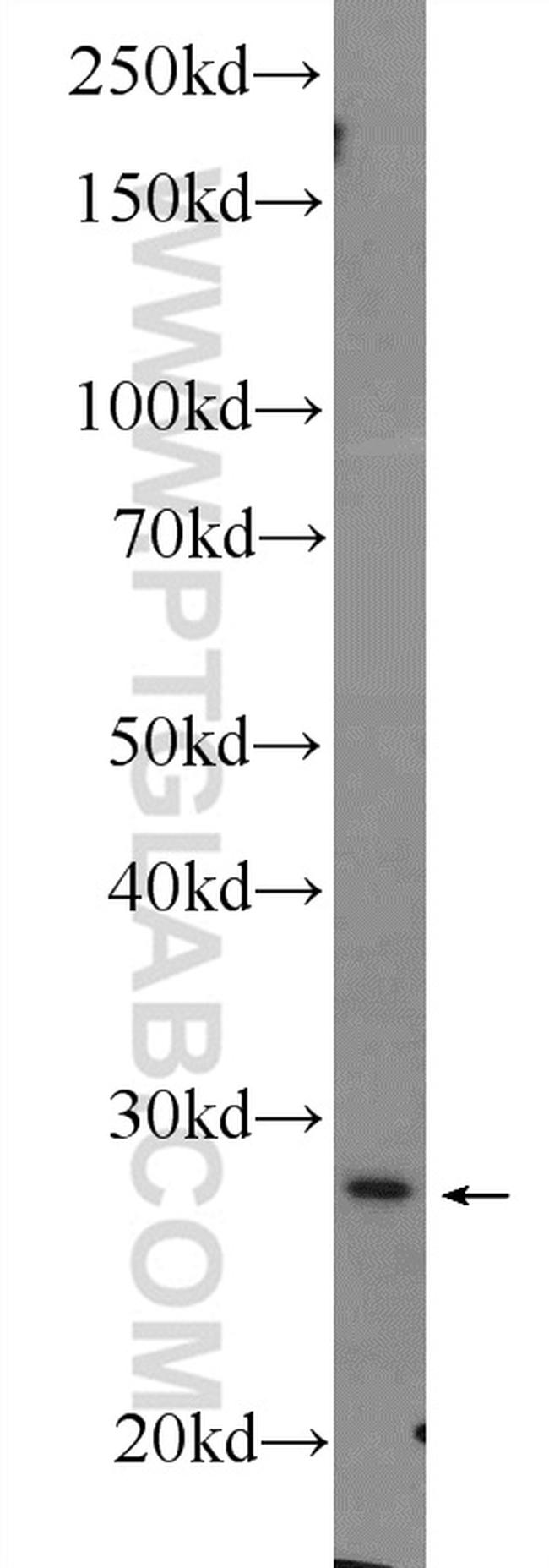 Cytoglobin Antibody in Western Blot (WB)