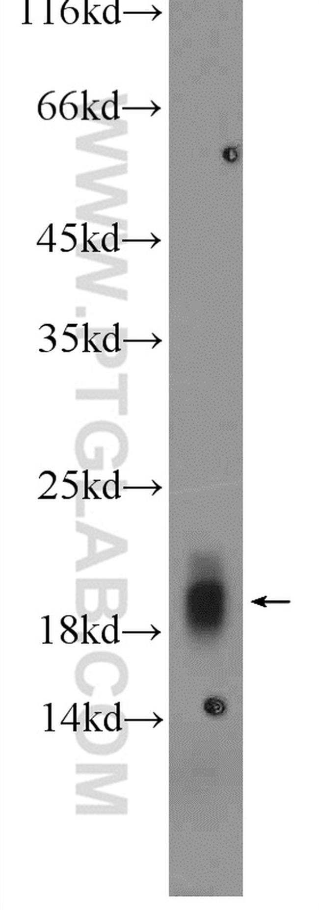 Cytoglobin Antibody in Western Blot (WB)