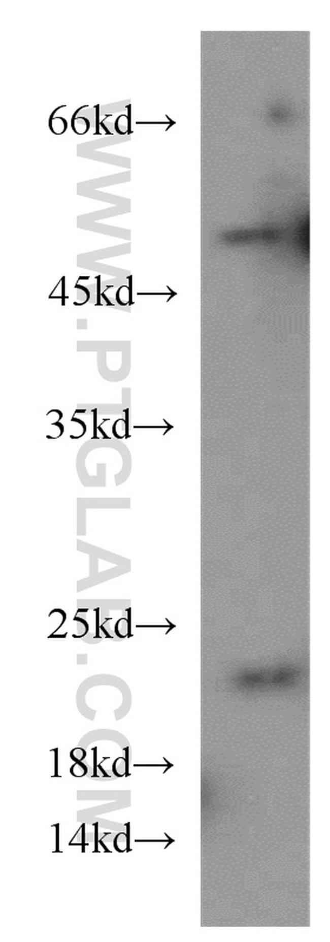 Cytoglobin Antibody in Western Blot (WB)