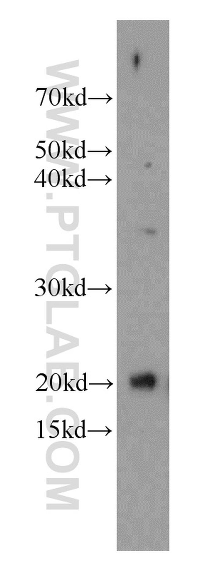 Cytoglobin Antibody in Western Blot (WB)