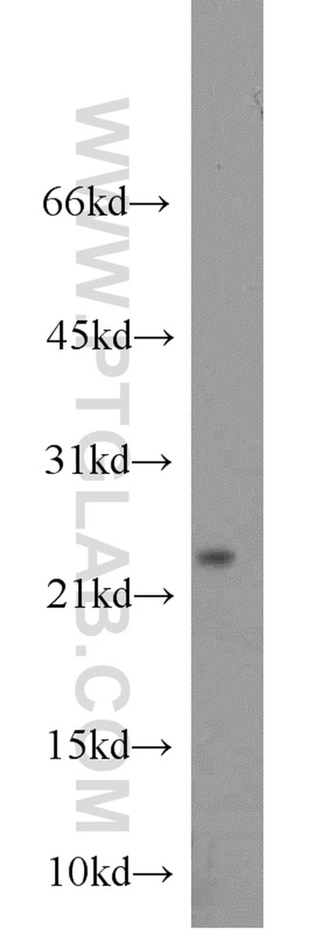 Cytoglobin Antibody in Western Blot (WB)