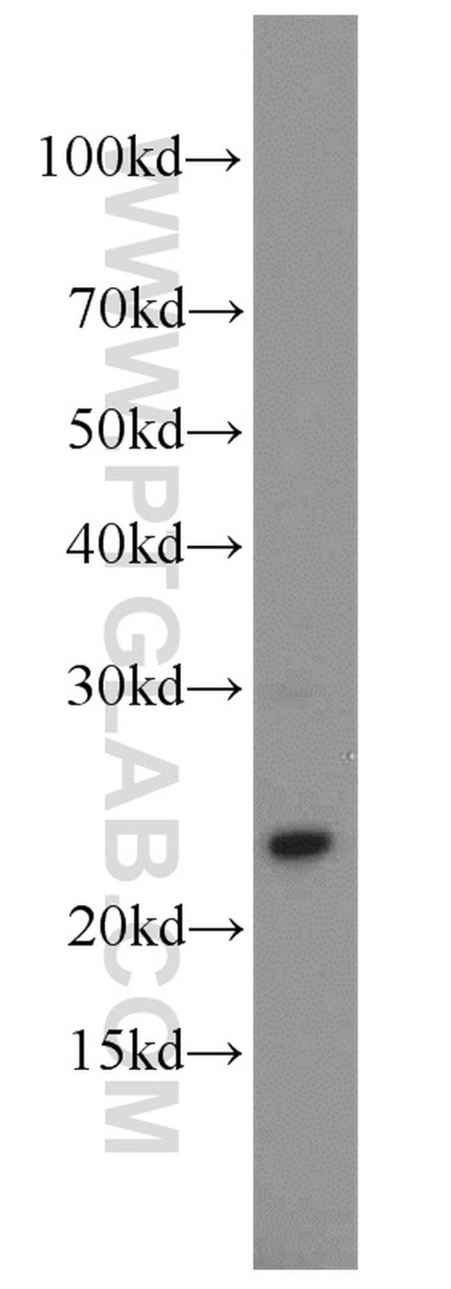 Cytoglobin Antibody in Western Blot (WB)