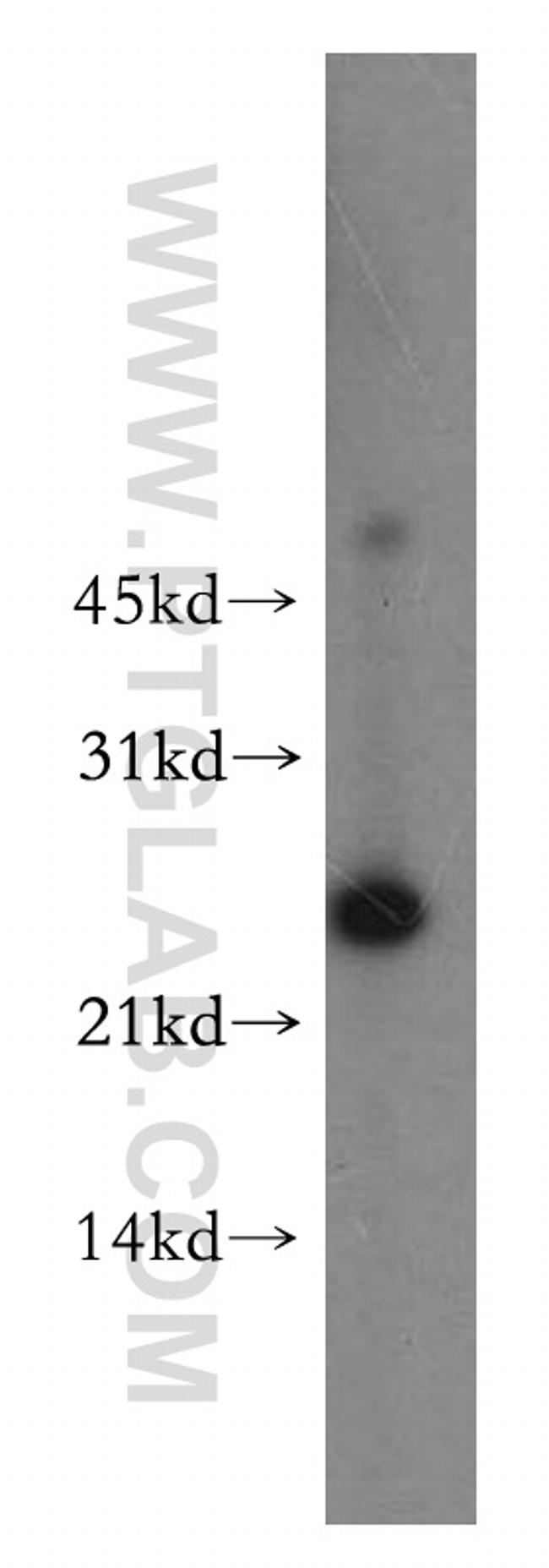 Cytoglobin Antibody in Western Blot (WB)