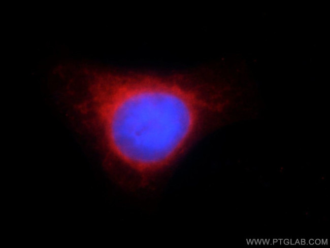 CISD2 Antibody in Immunocytochemistry (ICC/IF)