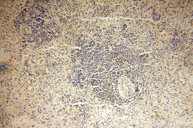 CISD2 Antibody in Immunohistochemistry (Paraffin) (IHC (P))