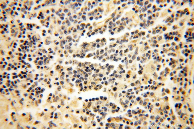 CISD2 Antibody in Immunohistochemistry (Paraffin) (IHC (P))