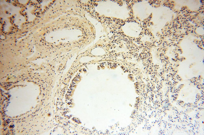 CISD2 Antibody in Immunohistochemistry (Paraffin) (IHC (P))