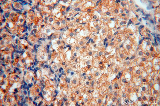 CISD2 Antibody in Immunohistochemistry (Paraffin) (IHC (P))