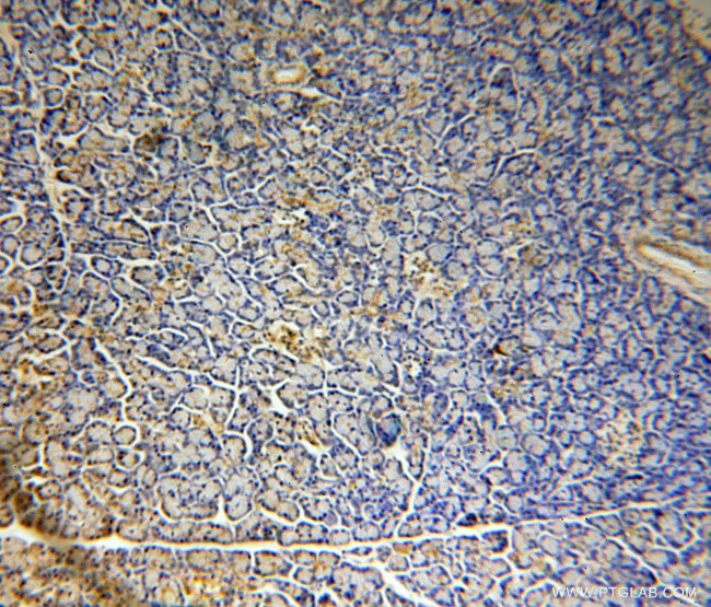 CISD2 Antibody in Immunohistochemistry (Paraffin) (IHC (P))