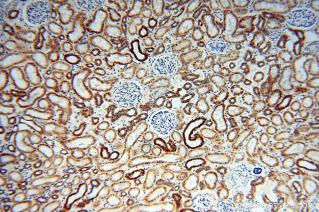 CISD2 Antibody in Immunohistochemistry (Paraffin) (IHC (P))