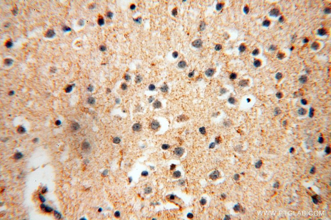 CISD2 Antibody in Immunohistochemistry (Paraffin) (IHC (P))