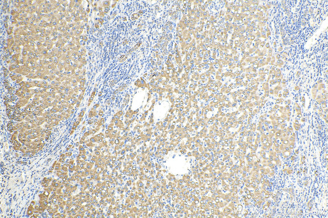 CISD2 Antibody in Immunohistochemistry (Paraffin) (IHC (P))