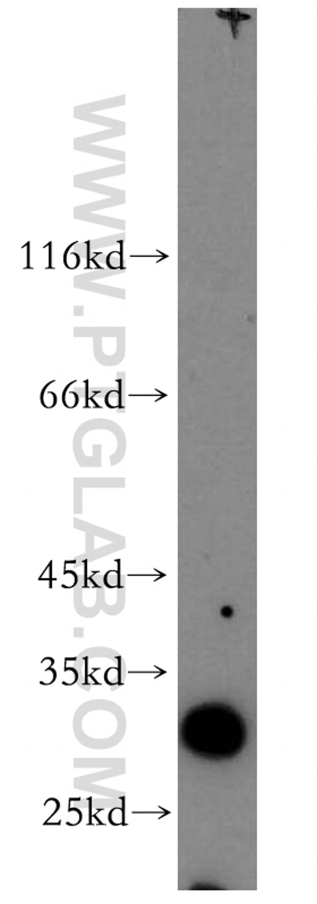 SLC17A5 Antibody in Western Blot (WB)