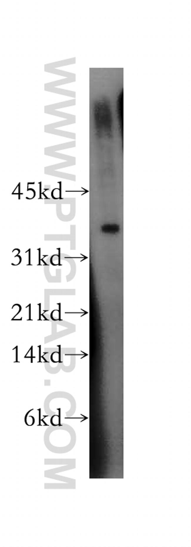 TSG-6 Antibody in Western Blot (WB)