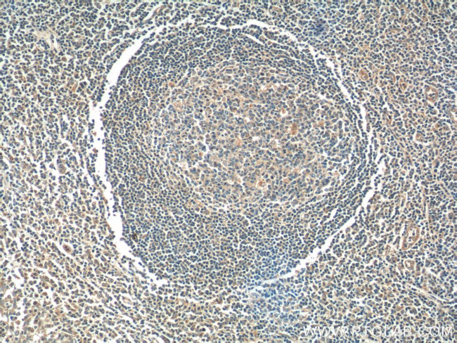 ADA Antibody in Immunohistochemistry (Paraffin) (IHC (P))