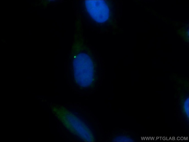 BUB1 Antibody in Immunocytochemistry (ICC/IF)