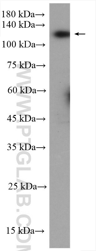 BUB1 Antibody in Western Blot (WB)