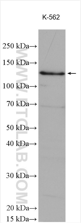 BUB1 Antibody in Western Blot (WB)