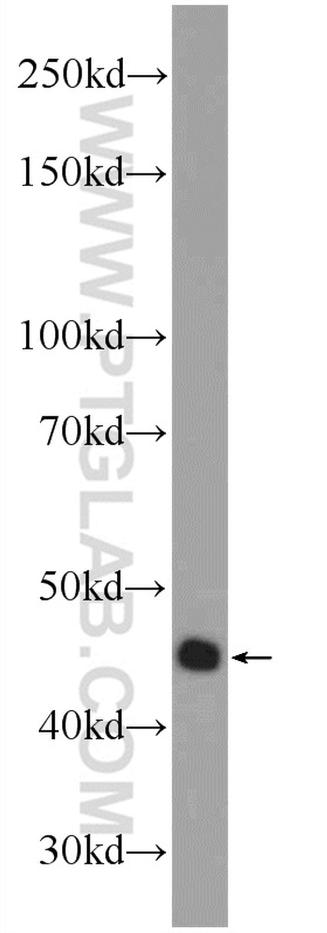 BUB1 Antibody in Western Blot (WB)