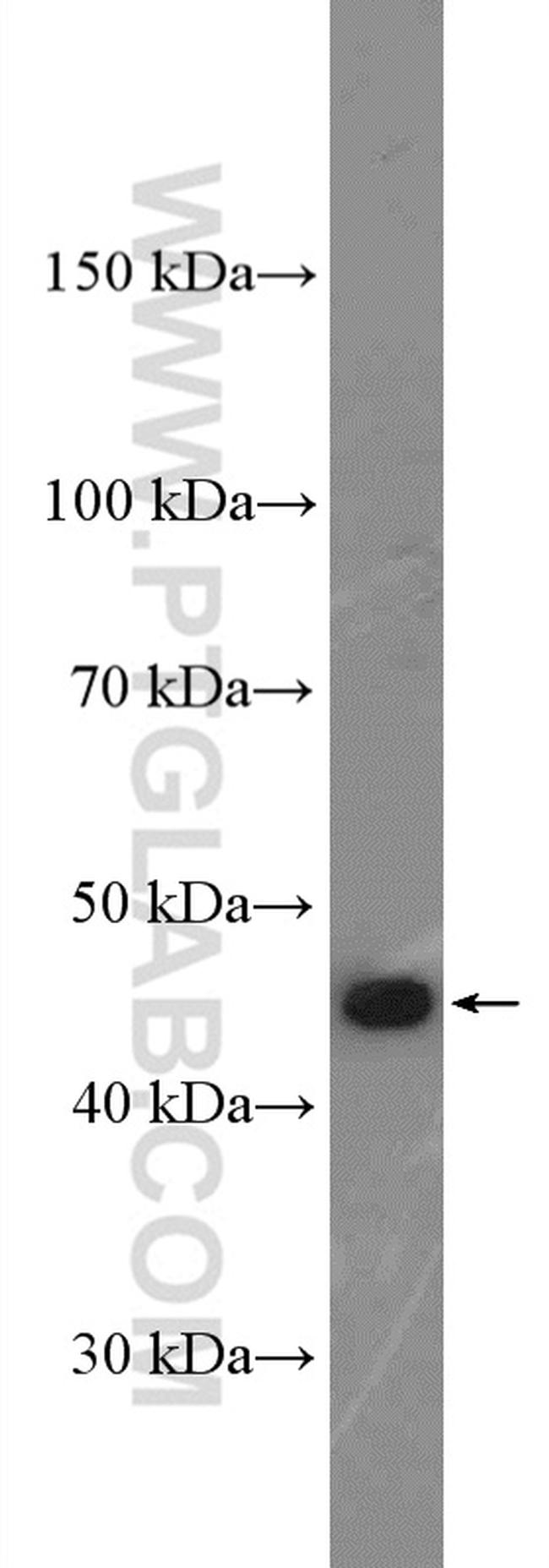 CD94 Antibody in Western Blot (WB)