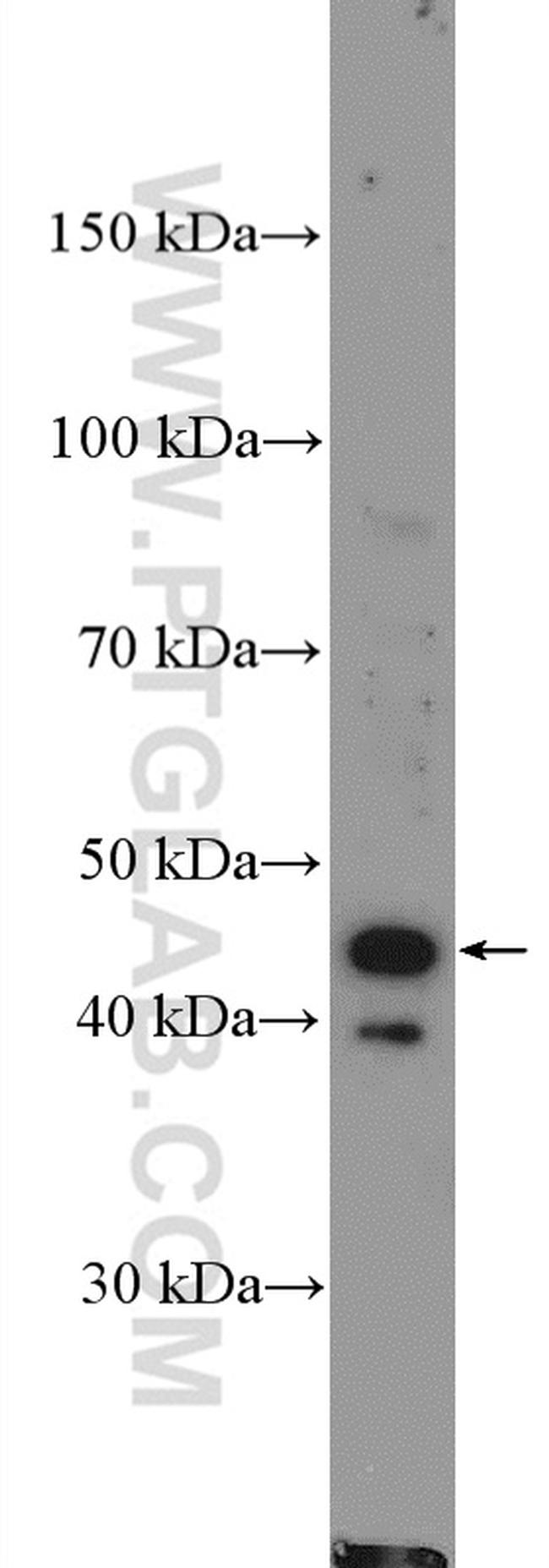 CD94 Antibody in Western Blot (WB)