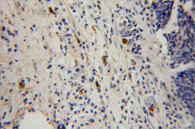 HK3 Antibody in Immunohistochemistry (Paraffin) (IHC (P))