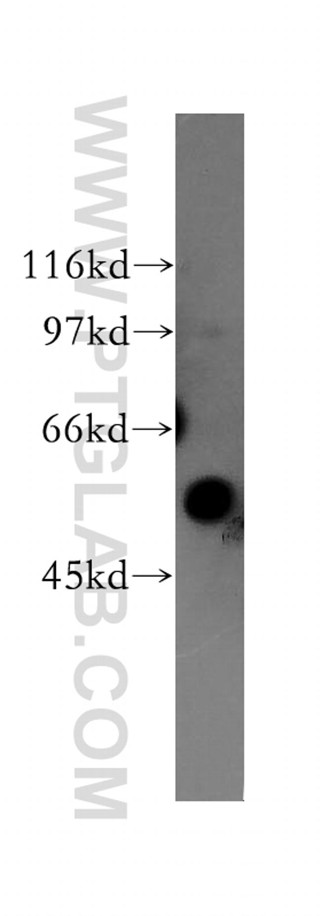 KIR3DL1 Antibody in Western Blot (WB)