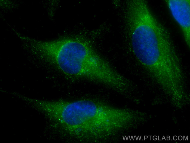 PPP3CB Antibody in Immunocytochemistry (ICC/IF)