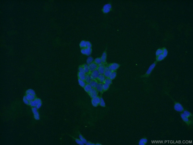 PPP3CB Antibody in Immunocytochemistry (ICC/IF)