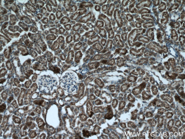 PPP3CB Antibody in Immunohistochemistry (Paraffin) (IHC (P))