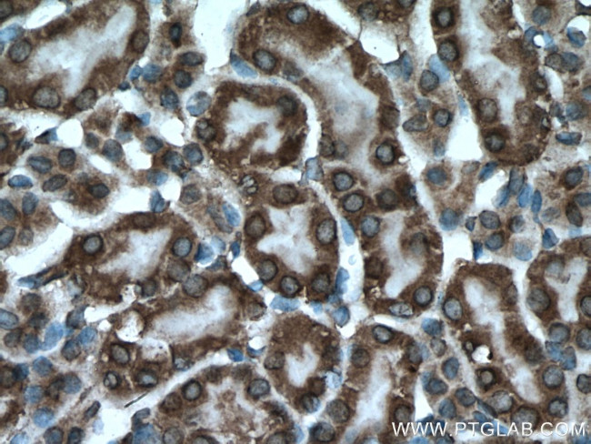 PPP3CB Antibody in Immunohistochemistry (Paraffin) (IHC (P))