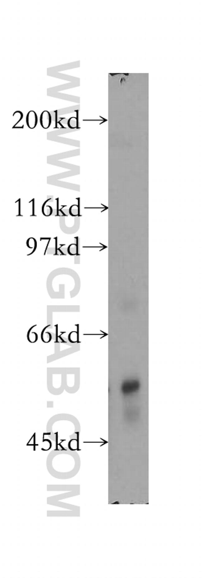 PPP3CB Antibody in Western Blot (WB)